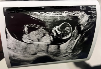 Can anyone see gender here?