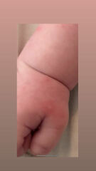 Really anxious. What is this? 13 week old. Spots on body