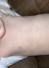 Rash - any thoughts?