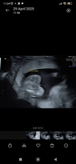 Gender Potty shot doubts? 16+1 weeks