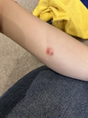 Weird spots 4 year old