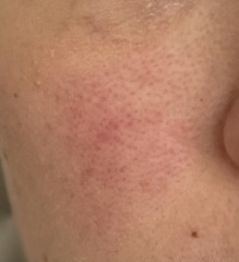 Skincare recommendations (pics!)
