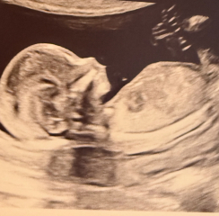 Just for fun guess the gender x