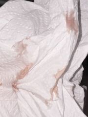Tmi pic - implantation bleeding or period?