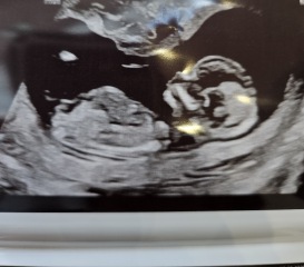 Boy or girl?