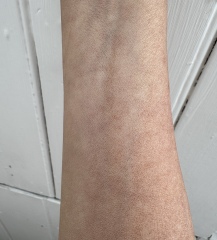 Having weird  issues with fake tan (images)