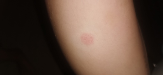 What does this look like to you?