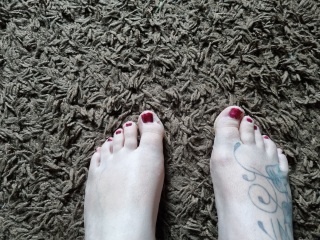 Bunion??