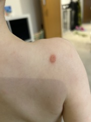 Weird spots 4 year old