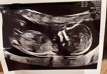 Can anyone see gender here?