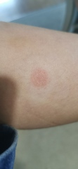 What does this look like to you?
