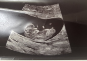 Can anyone help me it’s boy or girl 12 week scan