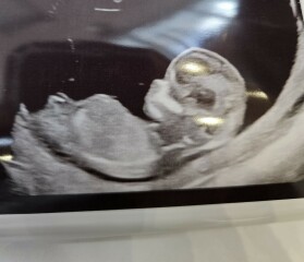 Boy or girl?