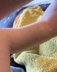 Undiagnosed skin condition