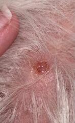 Could this be skin cancer?