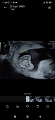 Gender Potty shot doubts? 16+1 weeks
