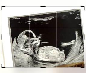 14 week ultrasound gender guess?