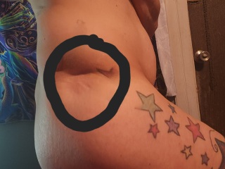 Hip dent