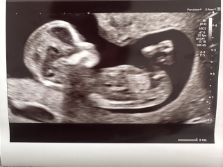 Gender guesses nub theory?
