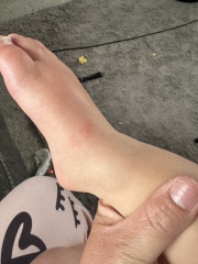 To take him to hospital?