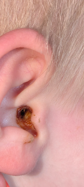Ear wax (photo attached)