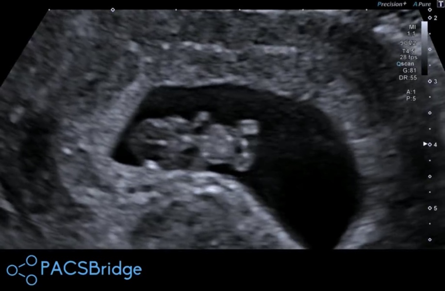 Due February 2026 ✨