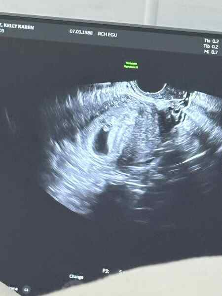 Anyone any good at ramzi?