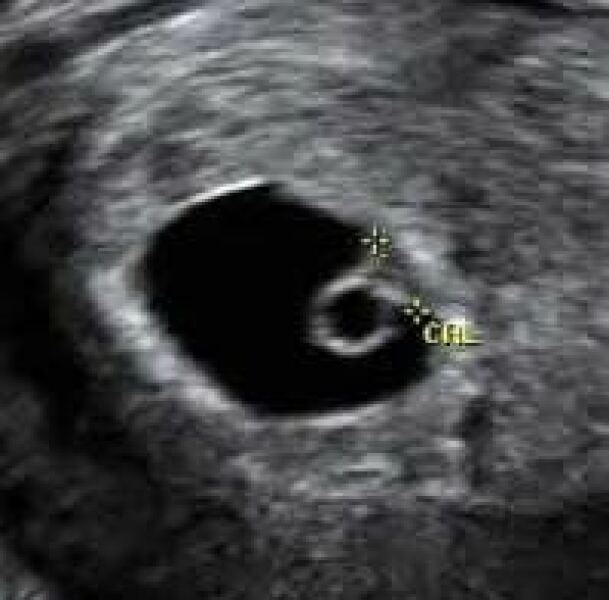 Due February 2026 ✨