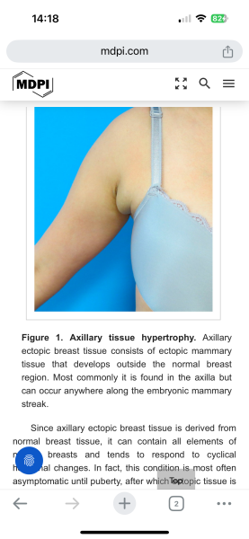 Vest tops which eliminate the armpit scrotum pouch.