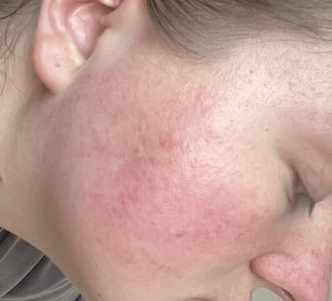 What is wrong with my skin😔 pics included