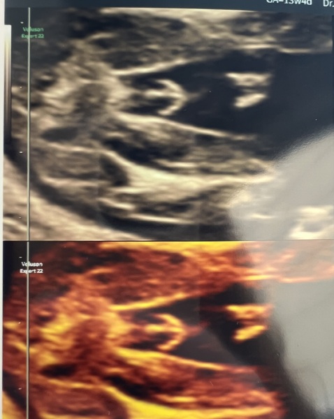 Boy or girl