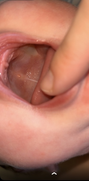 Newborn’s mouth