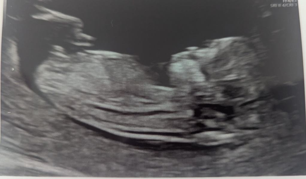 Due December 2025