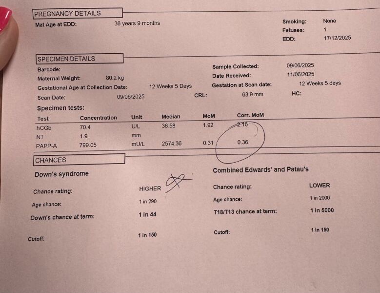 High risk Down’s syndrome- low Papp A? Could someone translate my combination results?