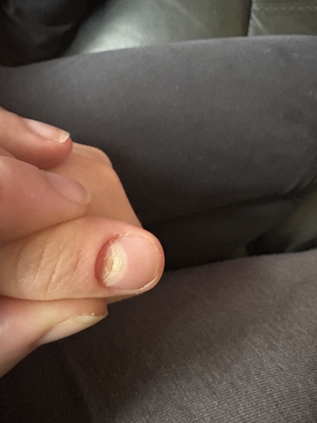 Is this nail going to fall off? Picture included