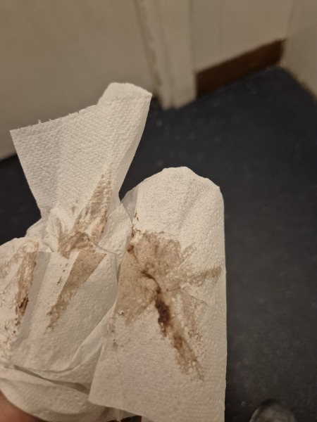 Is this implantation?