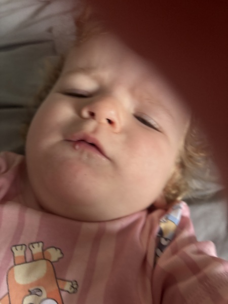 Cut that turned into a white blister?