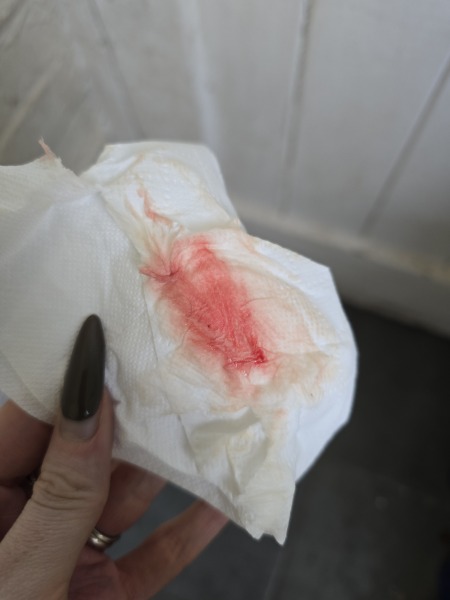 Am I losing my pregnancy?
