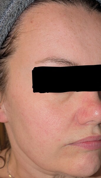 If this was your face, what skincare routine would you have?
