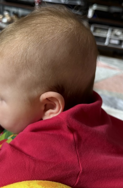 Does my baby look like she has a flat head?