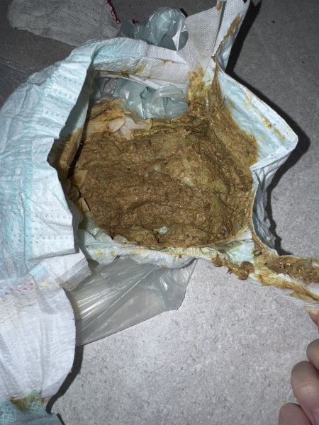 Is this poo normal? (Warning - poo pic attached)