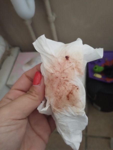 TW blood (possible miscarriage)