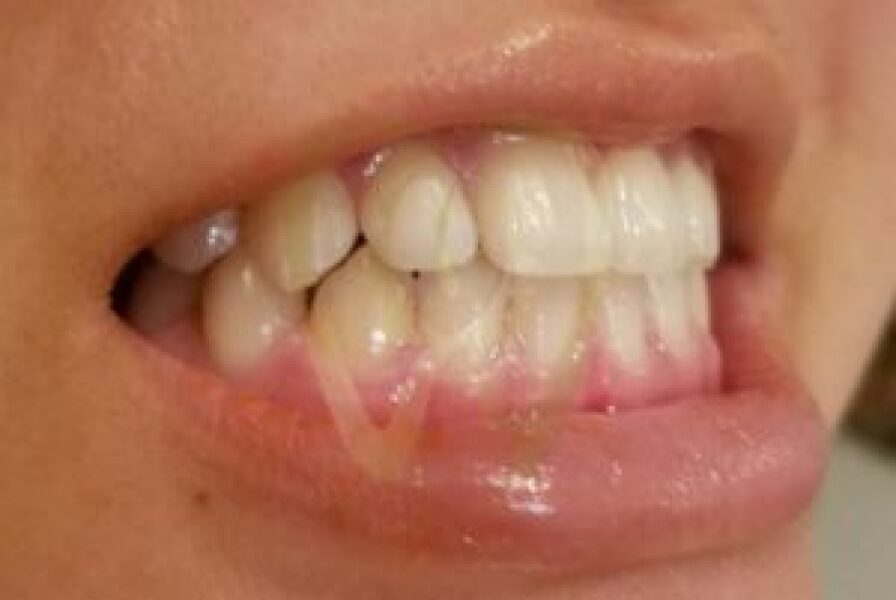 Any orthodontists or teeth people?! PLEASE