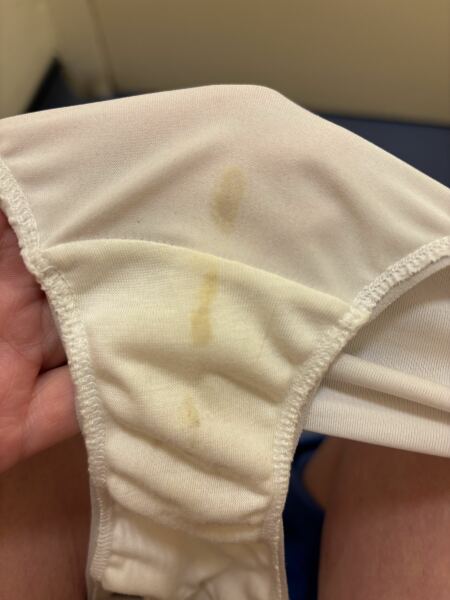 Implantation spotting? TMI picture