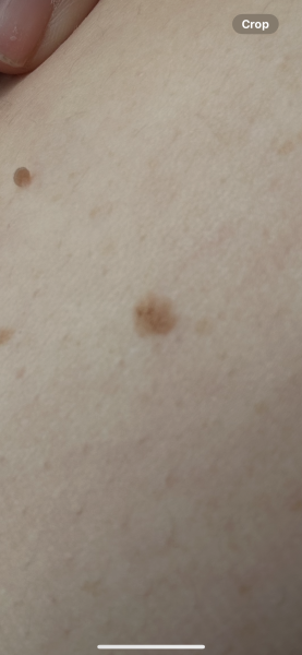 Mole