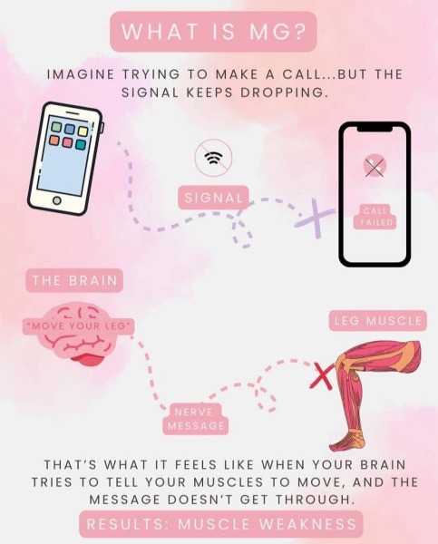 I often fake how bad my disability is- AMA