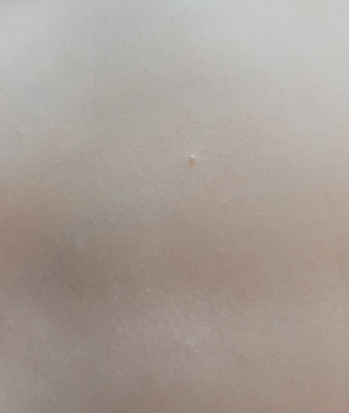 What are these spots?