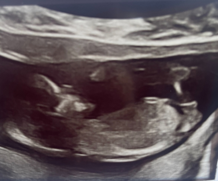 Nub Theory - 13 weeks