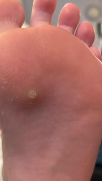 What's this on DD's foot?