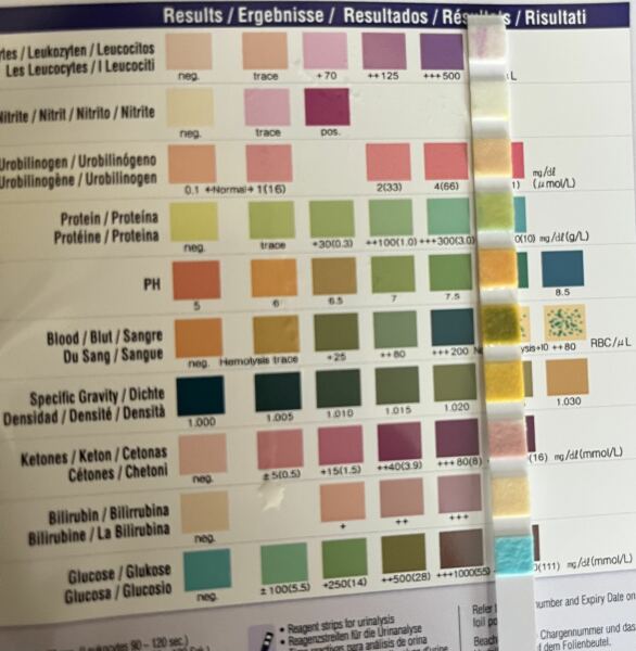 Urine test